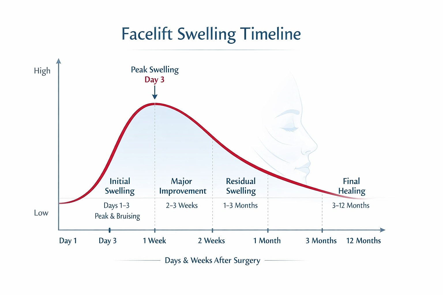 Facelift swelling timeline post-surgery chart.