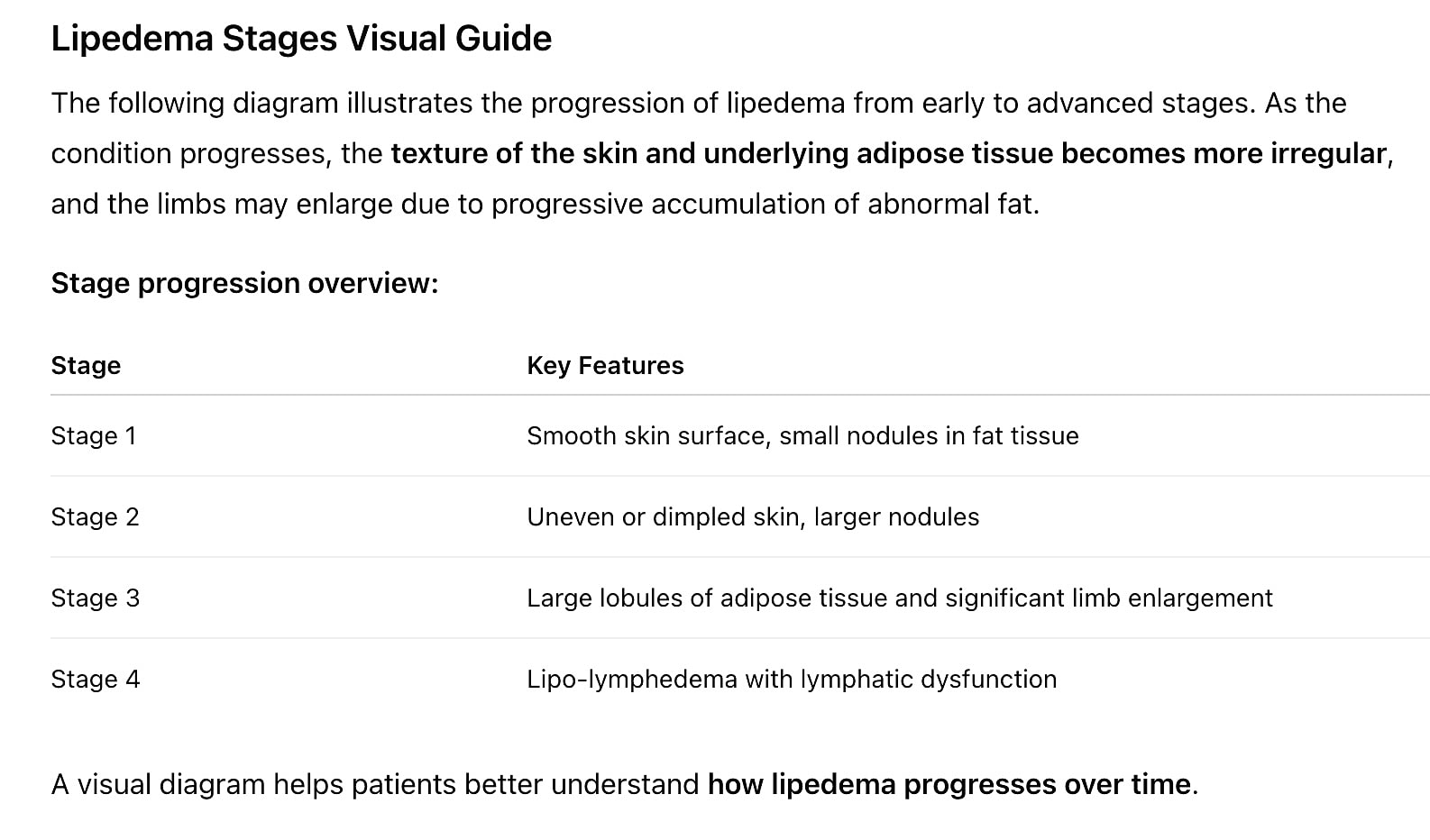 Lipedema stages visual guide for patient understanding.