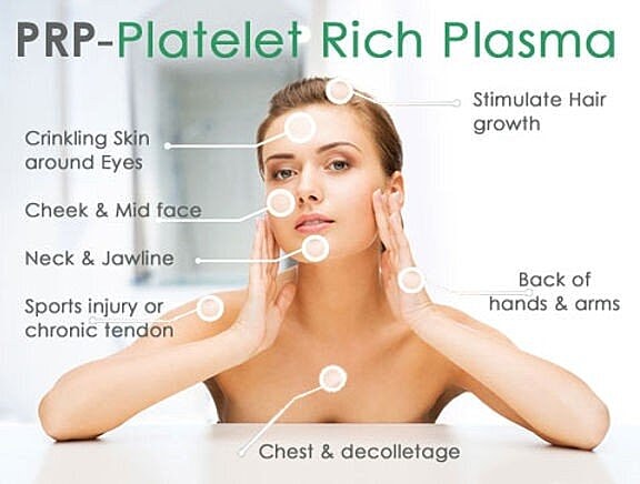 PRP (Platelet - Rich Plasma) Facial Rejuvenation The Woodlands I Houston