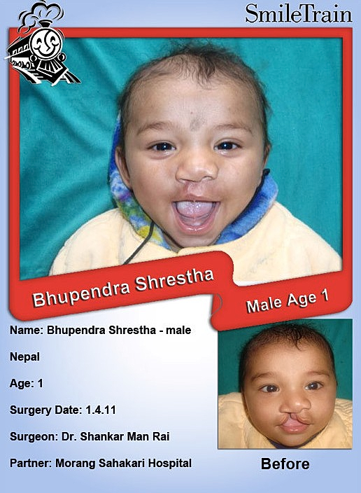 Smile Train of The Week