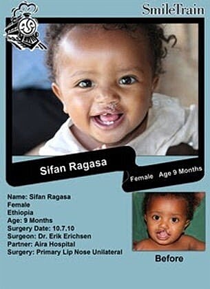 Smile Train & Operation Smile of the Month