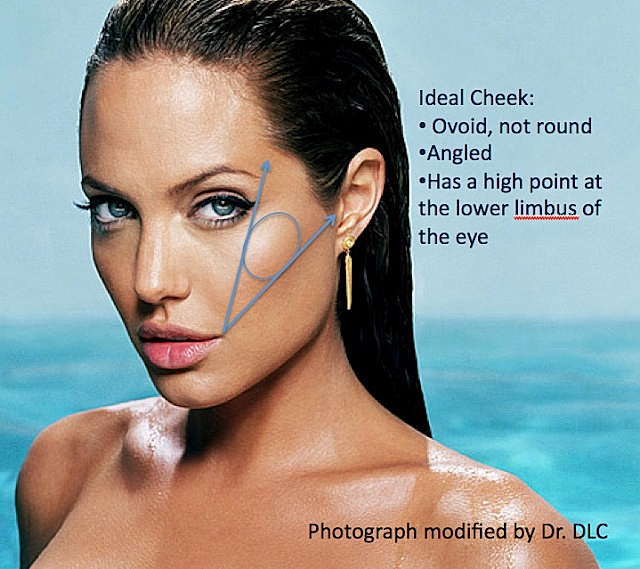 The Fine Art behind Facial Fat Transfer| Houston