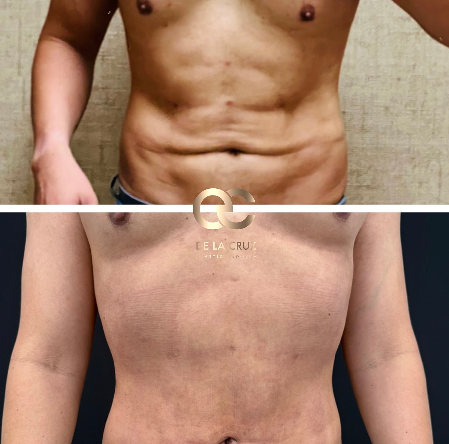 Before and after plastic surgery body transformation.