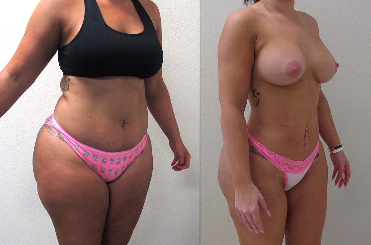 Biopolymer Removal Before & After