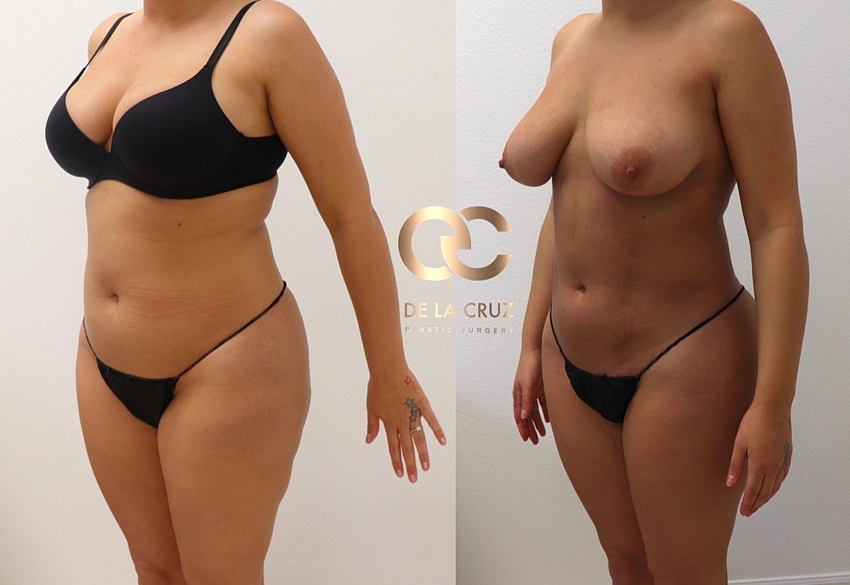 Biopolymer Removal Before & After