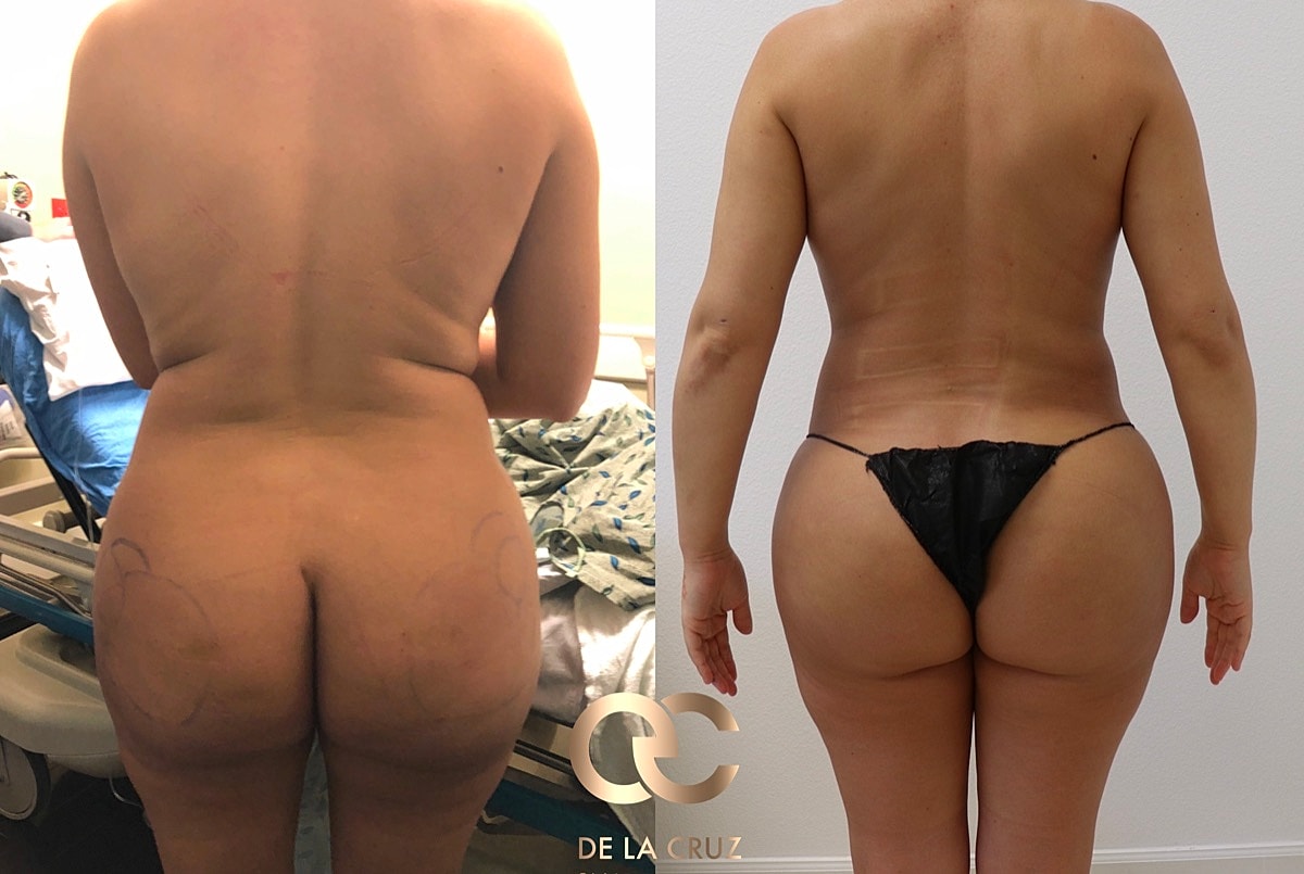 Biopolymer Removal Before & After