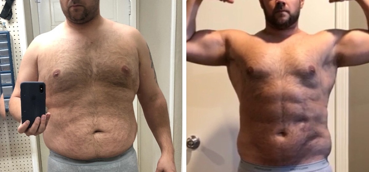 Large Volume High Def Liposuction Before & After