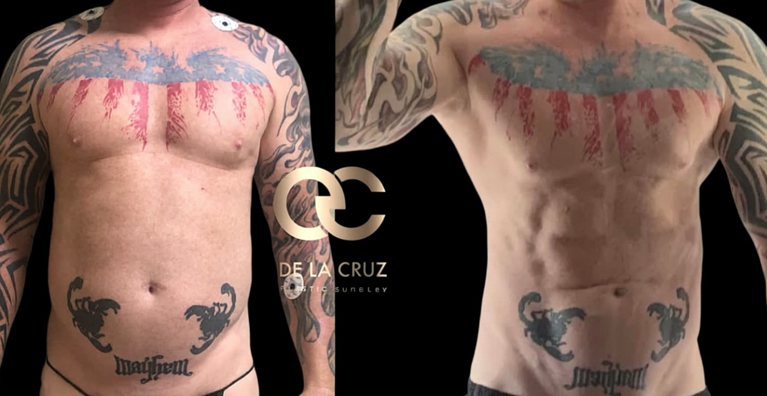 Tattooed man before and after body transformation.