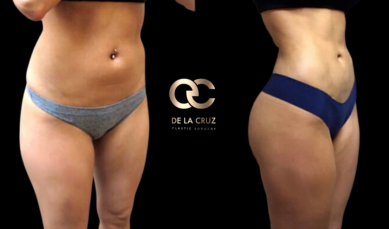 Before and after body transformation photos.