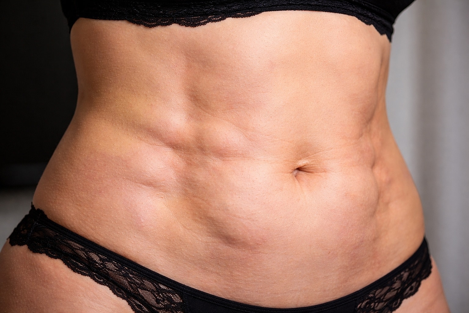 fibrosis and hard lumps after liposuction abdomen
